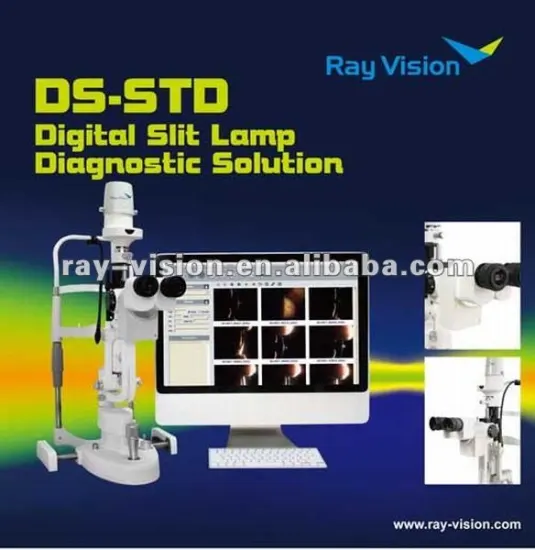 Digital ophthalmic slit lamp