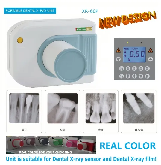 High frequency digital portable x-ray unit many colours