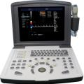 Portable Color Doppler Ultrasound Machine for Obstetrics