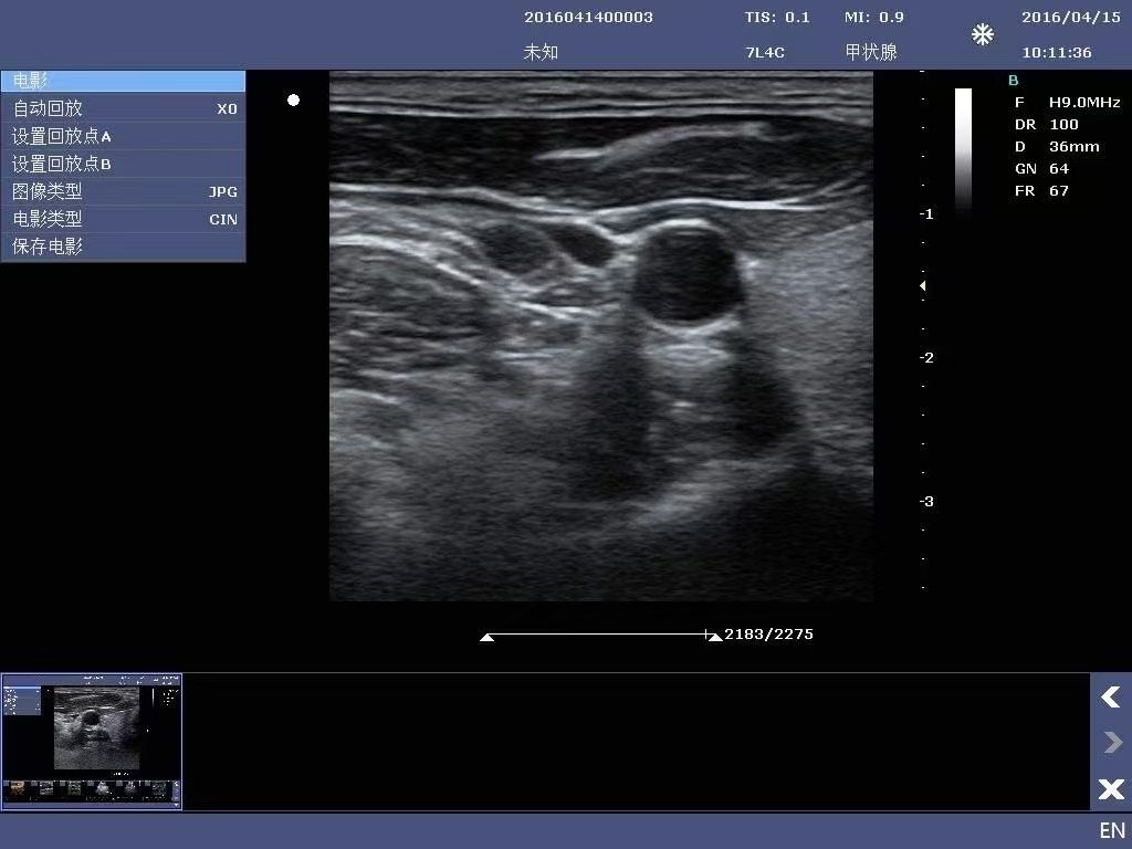 doppler ultrasound machine
