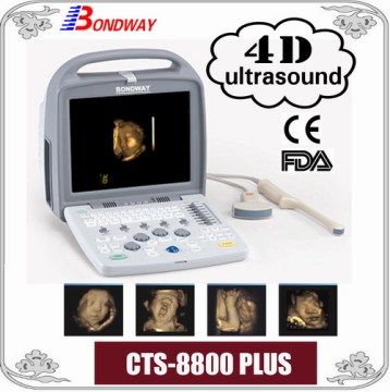 Portable 3D/4D Ultrasound Scanner, Color Ultrasound Scanner, Doppler Ltrasound Scanner (CTS8800 Plus)