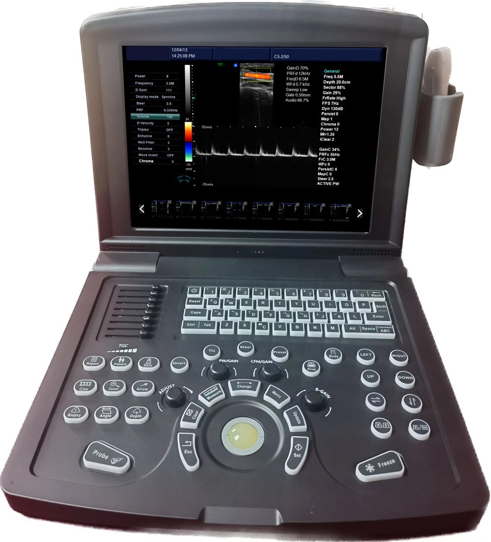 Tragbarer Farbdoppler -Ultraschallscanner