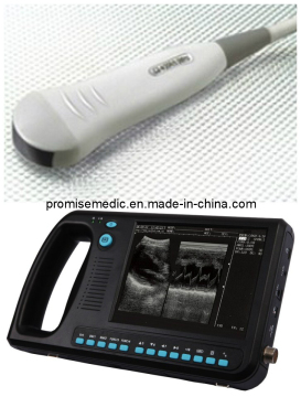 5.0 MHz Micro Convex Probe for Palmtop Ultrasonic Scanner (PRO-BCM100)