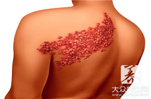 Wholesale Skin Care Led Light Therapy