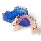 Precision Cast Of Valplast Flexible Denturers Partial With Thermo Injected Nylon Dentures