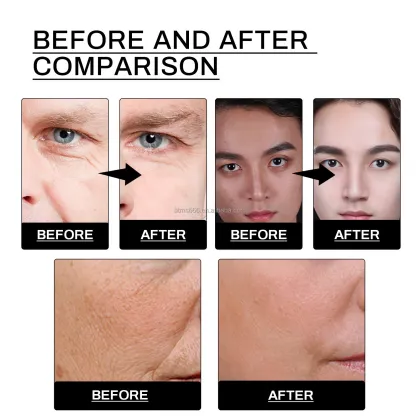 Niacinamide Skin Lightening Collagen Face Cream for Men