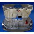 Modelo de patología de dientes de leche transparente