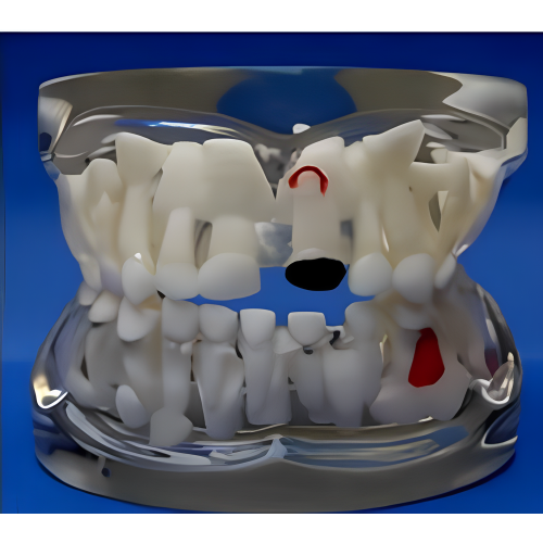 Прозрачная модель патологии молока зубами