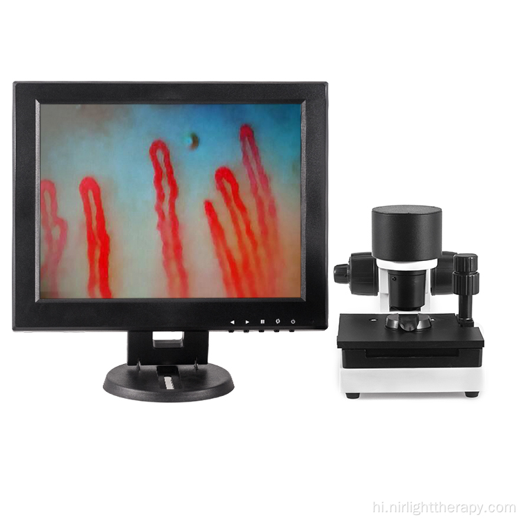 12 इंच रक्त केशिका microcirculation माइक्रोस्कोप