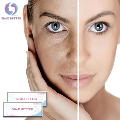 Hyaluronate Acid Gel Dermal Filler to Enhance your Beauty