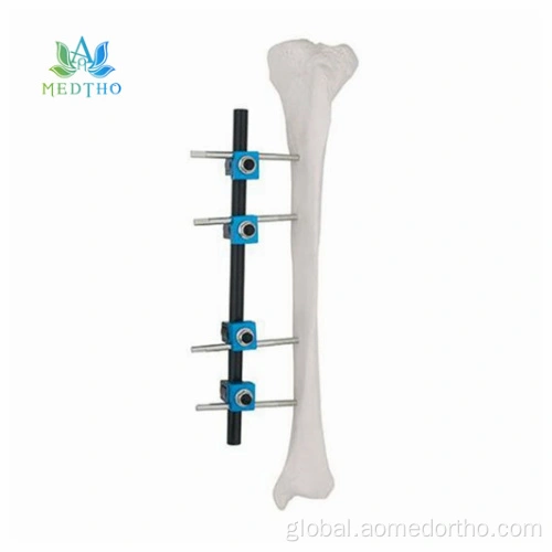External Fixation Device tibia ex fix Manufactory China Manufacturer ...