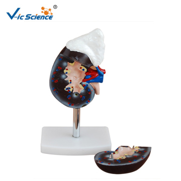 Human Kidney With Adrenal Gland Model