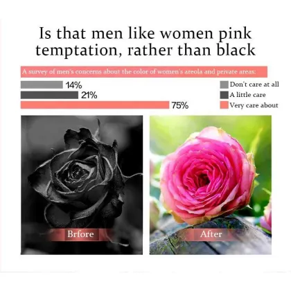 Intimate Whitening Cream Vagina Dark Spot Whitening Lotion Whitening Bleaching Cream