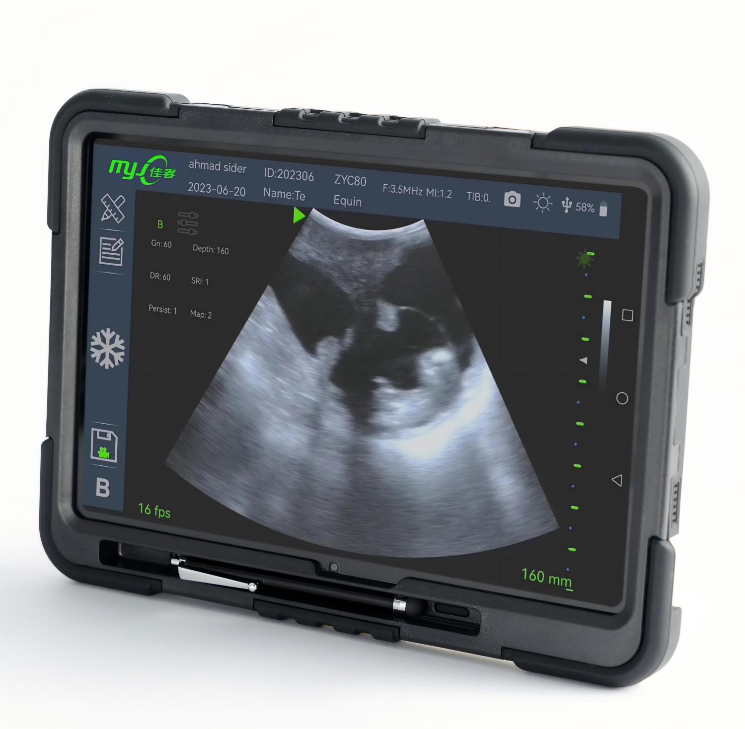 used veterinary ultrasound machine