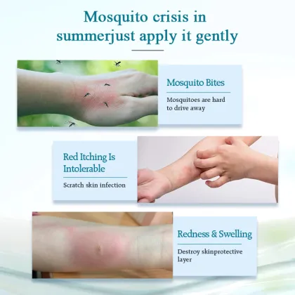 Private Label After Bites Soothing Gel 20ml - Mosquito Bite Itch Relief Pen