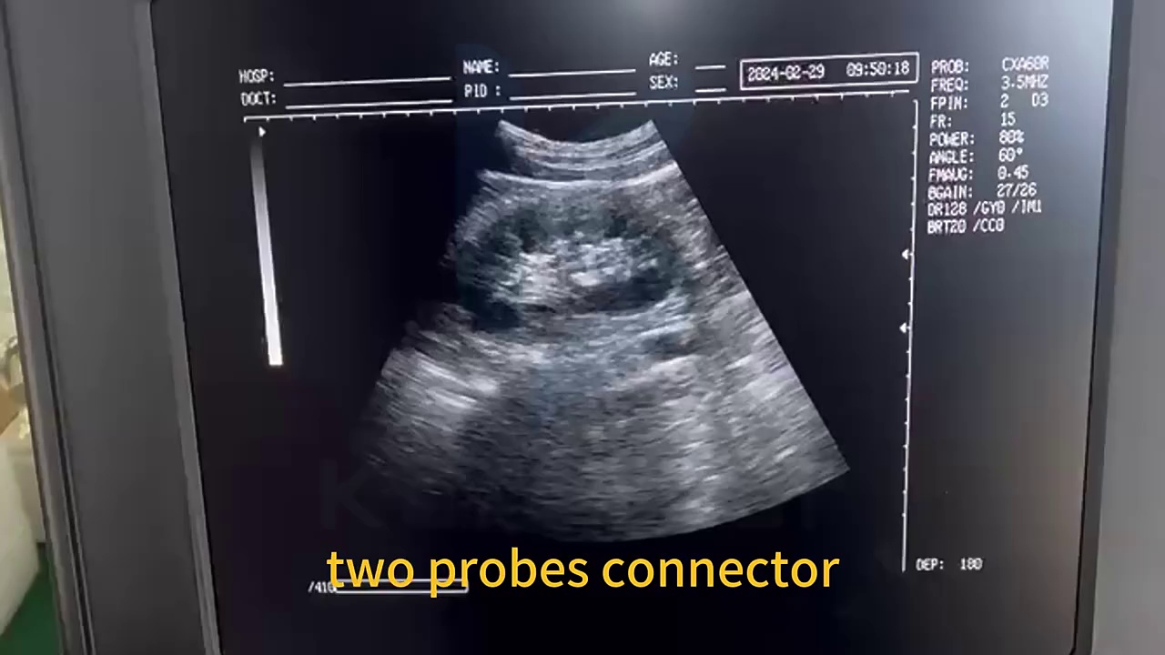 Portable B/W Ultrasound Diagnostic System