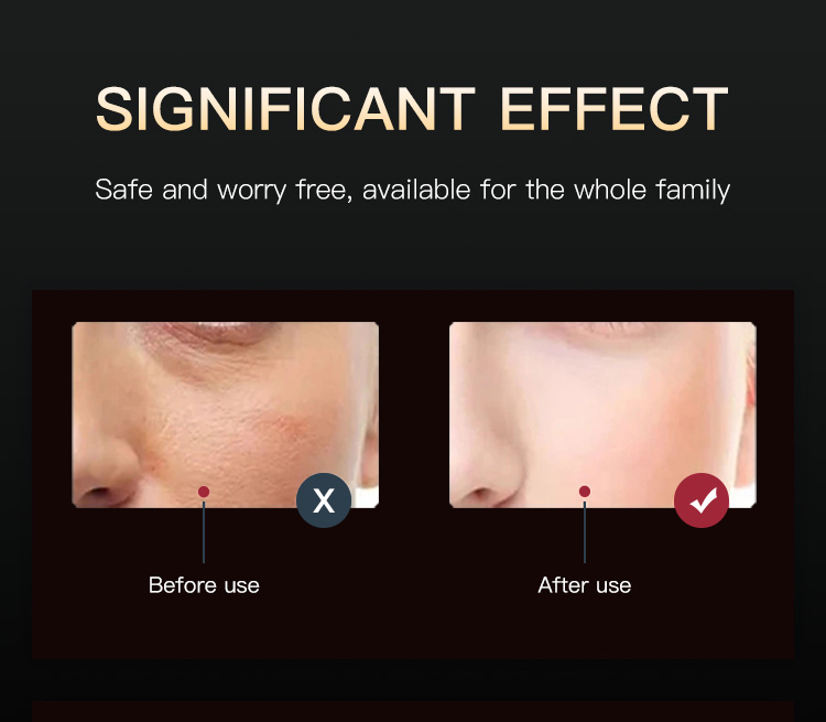 led light therapy face mask