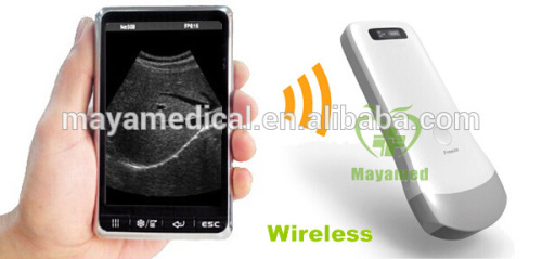 MY-A010B Factory Price Handheld Ultrasound Scanner New Ipad Ultrasound Scanner