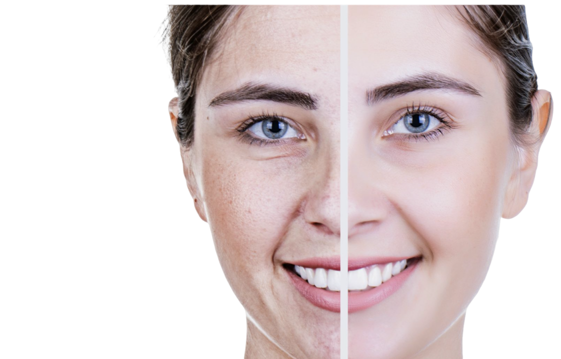 ectoine certificate of analysis