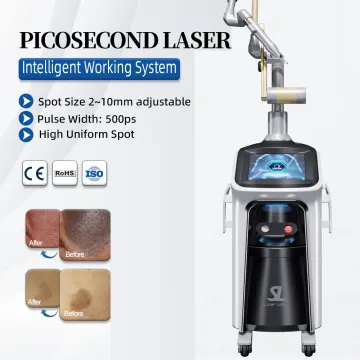 Professional 500W Beauty Laser Tattoo Removal Equipment - ND:YAG 3000mJ Tattoo Removal Machine