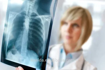 Fuji blue import export nayanthara blue film videos xray films