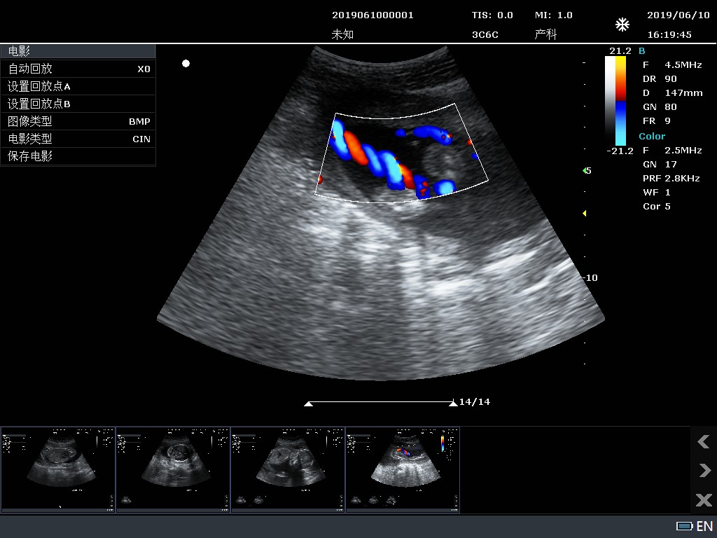 Umbilical cord color flow