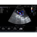 KPC-3C Convex Palm Doppler ультрагукавая сістэма