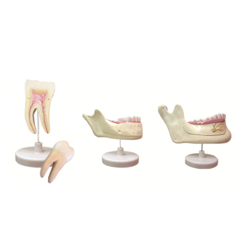 Natural Size Molars and Deciduous to Permanent Teeth Model ZM1049
