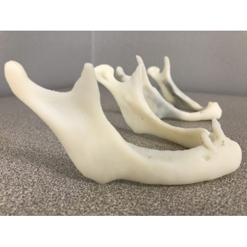 3D Printed medical implants