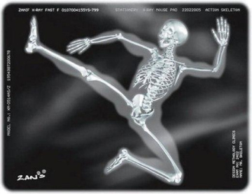 x ray medical image film (XILONG)