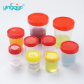 40ml Cup kiểm tra nước tiểu ở bệnh viện