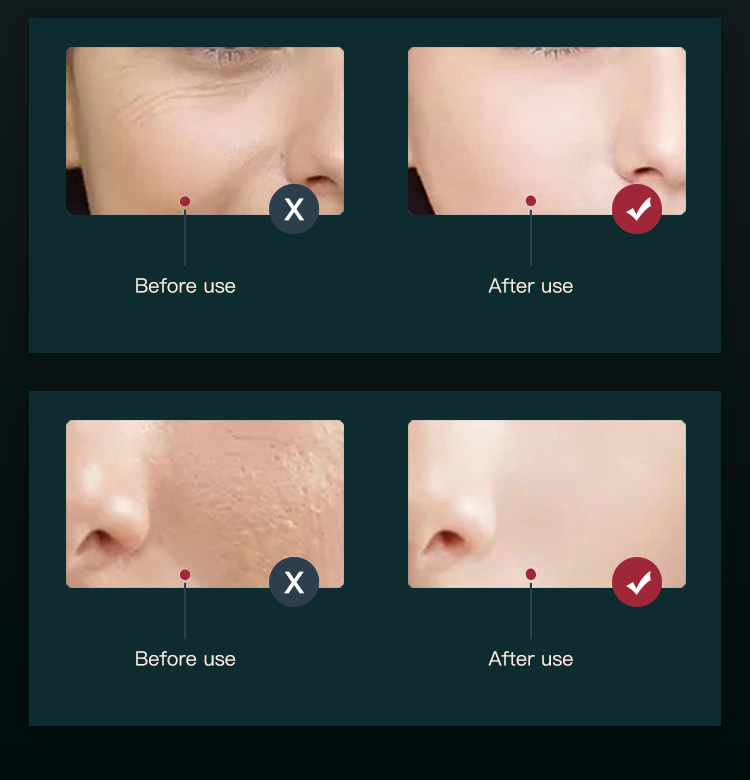 home use led light therapy dome