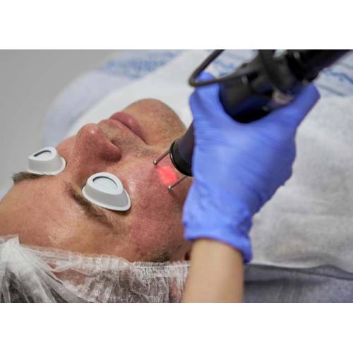 Laser Treatment Course Choicy Academy Acne Treatment Online Training Factory