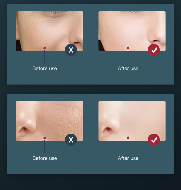 Red Light Therapy for Face LED Light Therapy (15)