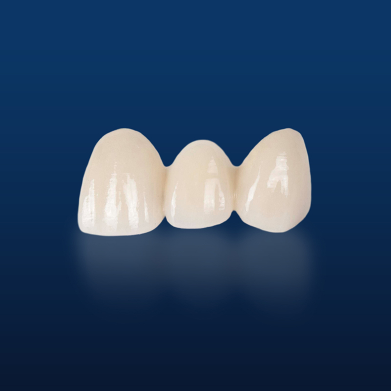 PFM,Metal crown,Fixed metal crown