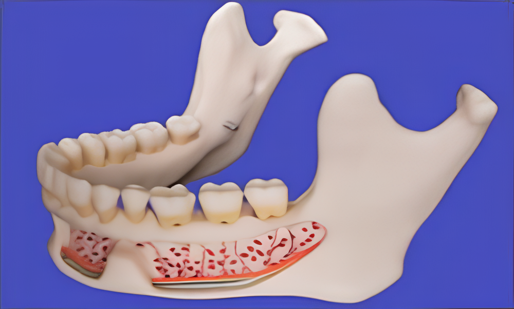 Modelo de mandíbula inferior (para fines educativos y médicos)