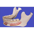 Modelo de mandíbula inferior (para fines educativos y médicos)
