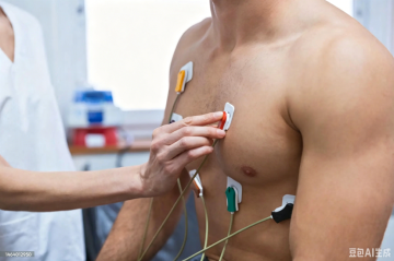 Premium-grade Disposable ECG Electrode for accurate and continuous cardiac monitoring.