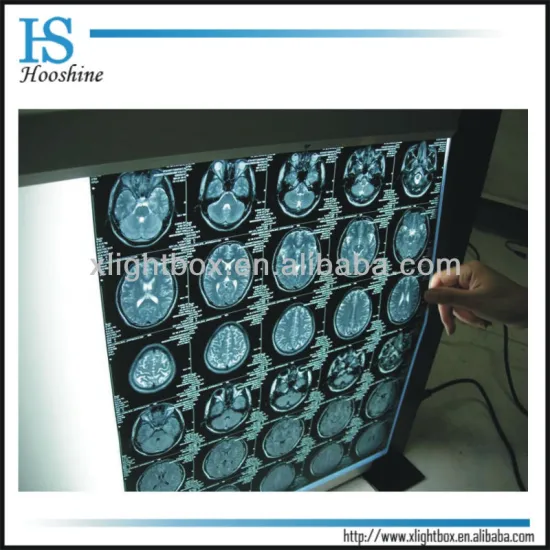medical X-ray flim viewer