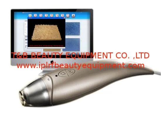 Portable Advanced 3d Digital Uv Skin Analysis Machine System Tb-ts06