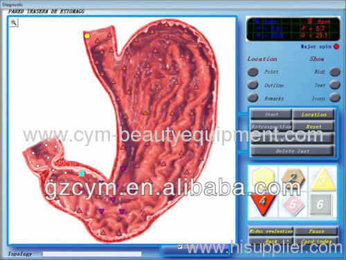 2013 Newest Physical Examination Health Analyzer--new Arrival 3d-nls Tester System Health Analyzer 