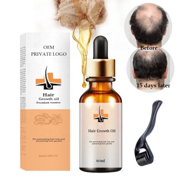 Vegan Rosemary Oil Serum for Natural Hair Growth and Anti-Hair Loss