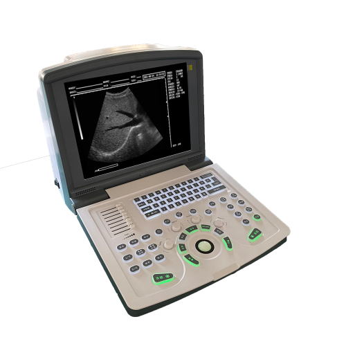 Portable digital black and white ultrasound scanner