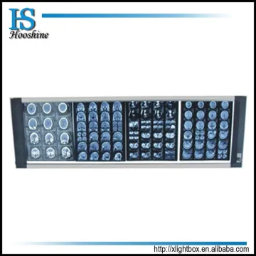 2015 Hot sale led medical negatoscope film viewer X-ray film viewer