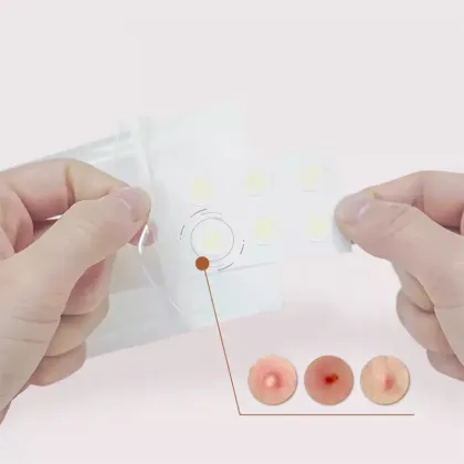 Butterfly XL Hydrocolloid Acne Pimple Patch