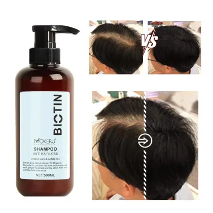 Organic Biotin Hair Care Treatment 500ml - Anti Hair Loss and Hair Growth Product