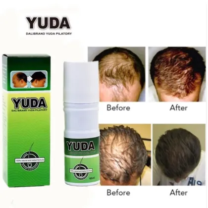 YUDA Effective Hair Loss Releasing Hair Growth Spray: Best Reputation