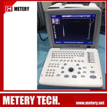 Medical diagnosis system MT300V