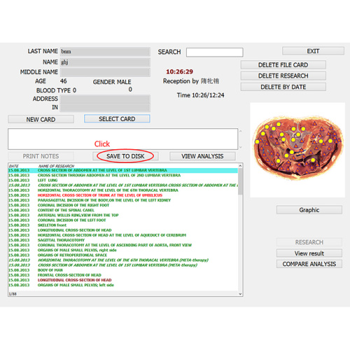 Quantitätsgesundheitsanalysator 9d Vektorlris nls