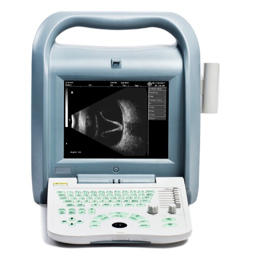 Ab Ophthalmilc Ultraschallbild (ODU8)